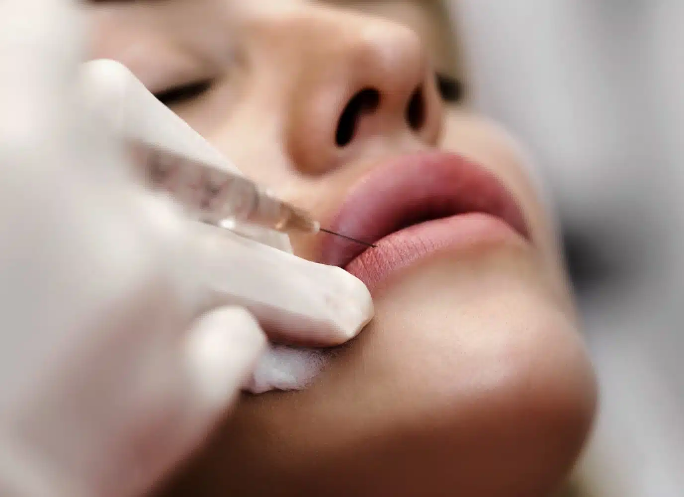 Injections lèvres à Argenteuil | Tarif injection acide hyaluronique | Médecine esthétique | Clinique Glaze
