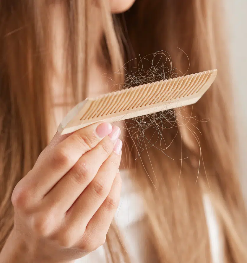 Perte de cheveux | Argenteuil et Sevran