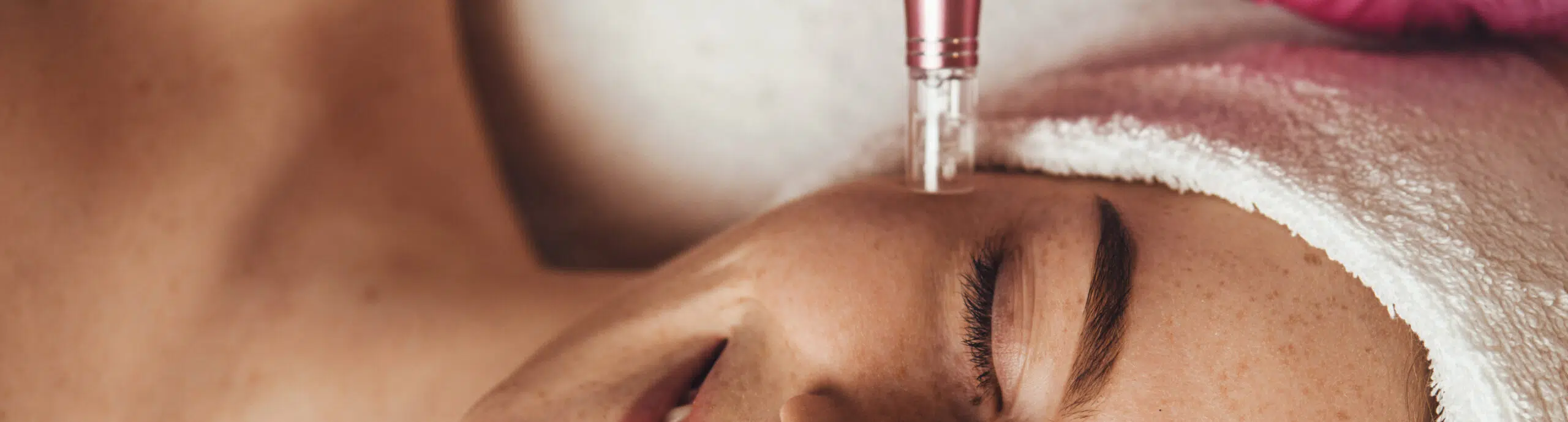 Les bienfaits de la mésothérapie pour prévenir le vieillissement cutané